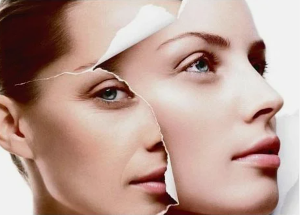 contraindications to laser rejuvenation